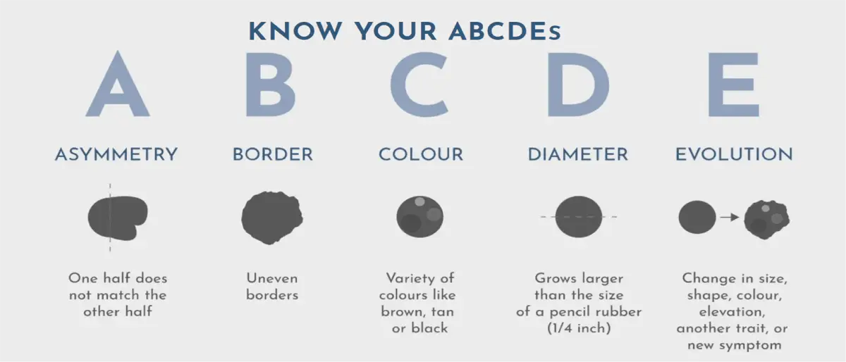 abcde